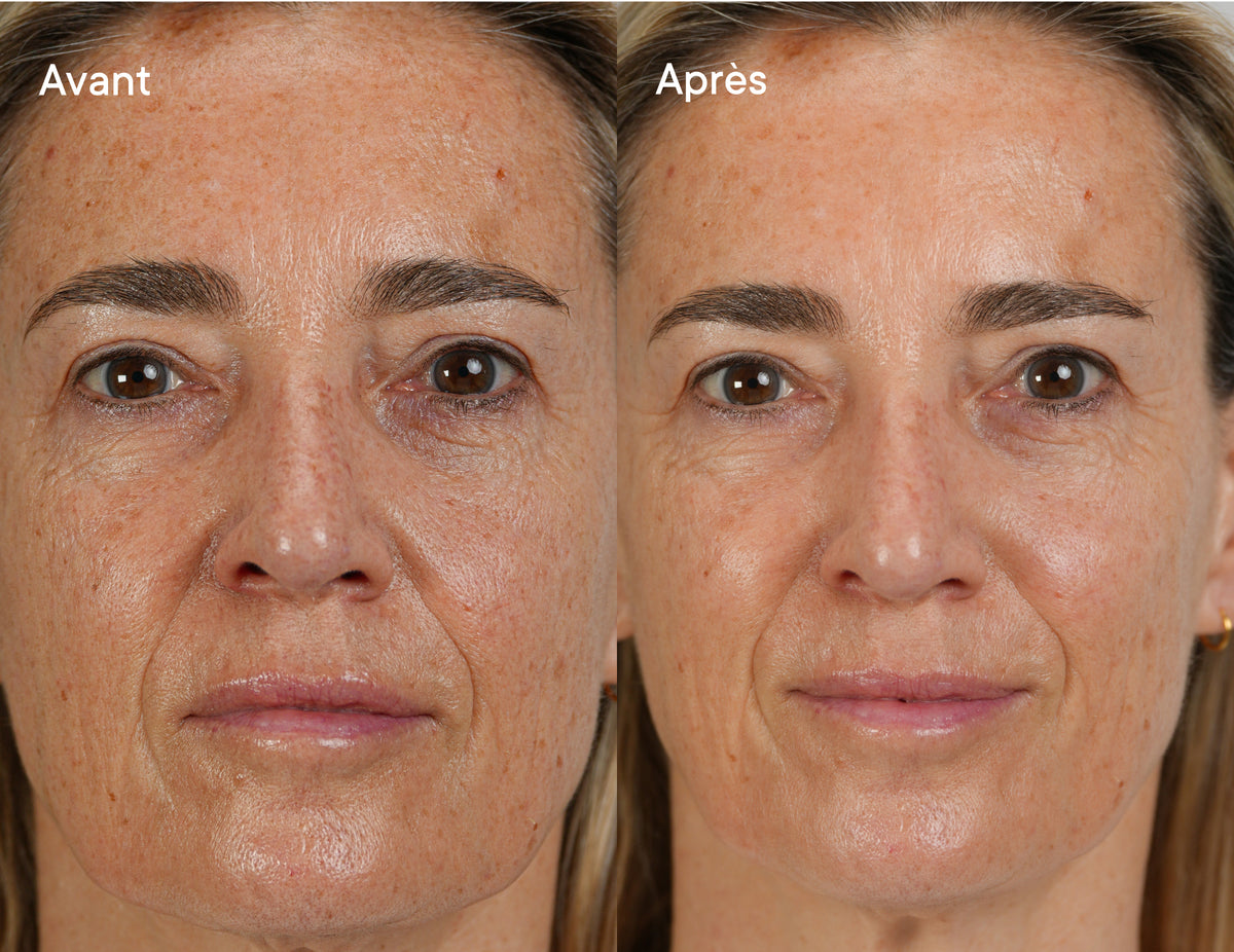 Real Results, Unretouched.