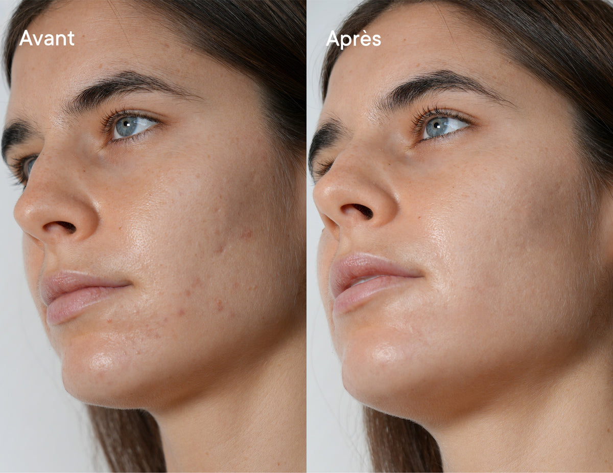 Real Results, Unretouched.