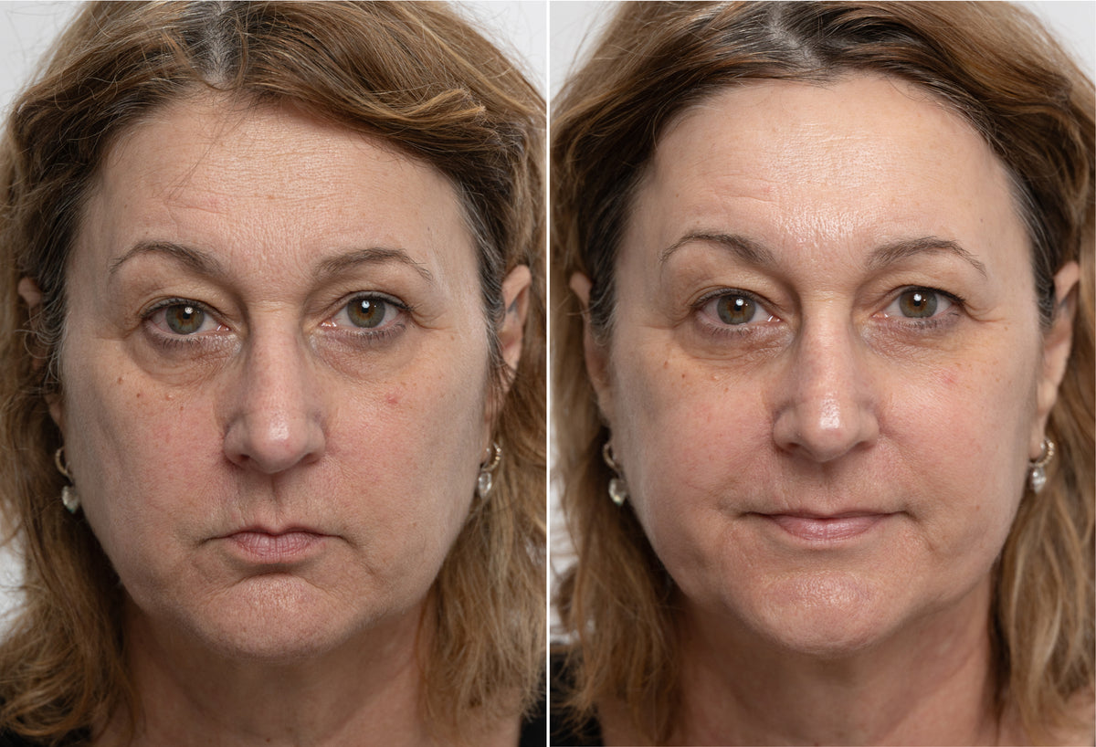 Real Results, Unretouched.