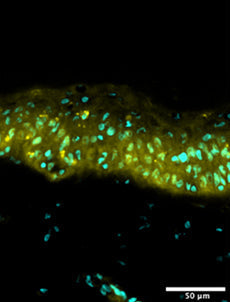 Strong reduction of inflammation