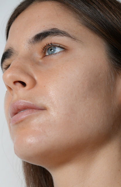 After — Corrective and Anti-Imperfection Treatment