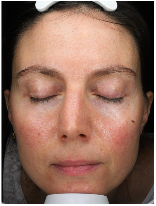 Real Results, Unretouched.