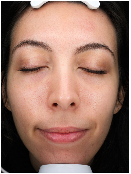 Real Results, Unretouched.