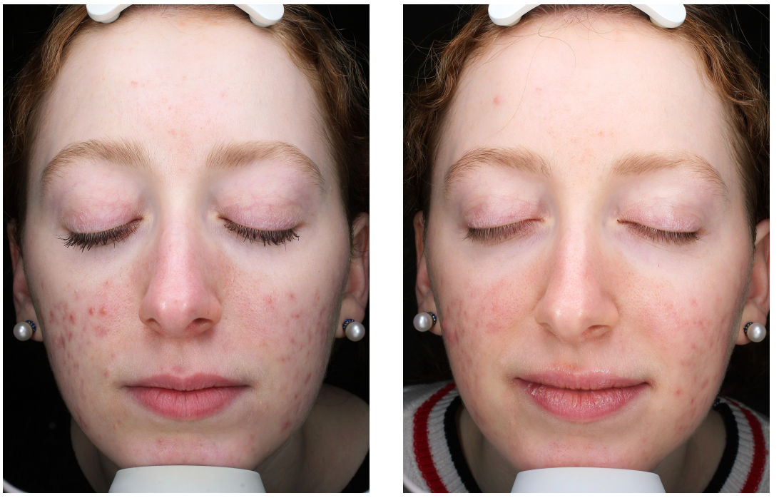 Real Results, Unretouched.