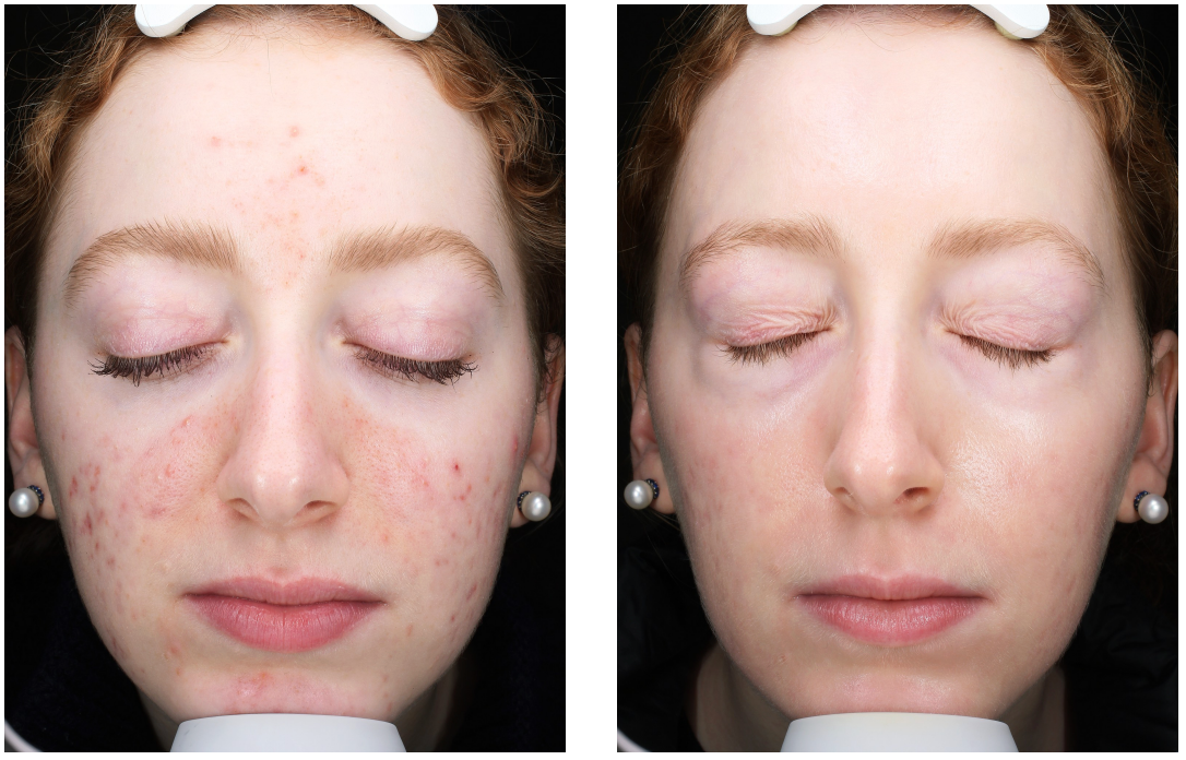 Real Results, Unretouched.