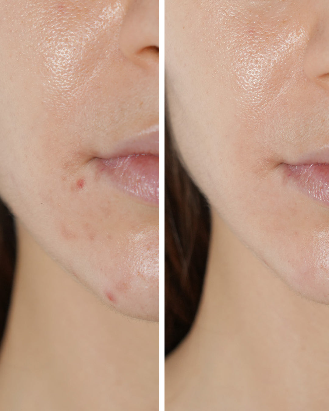 Real Results, Unretouched.