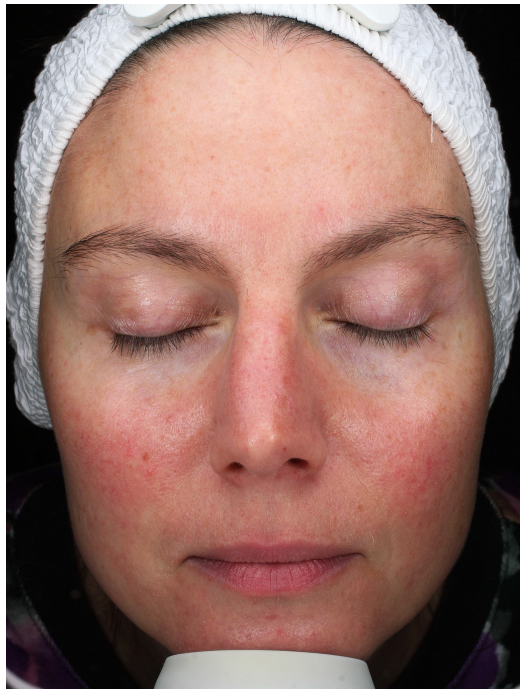 Real Results, Unretouched.