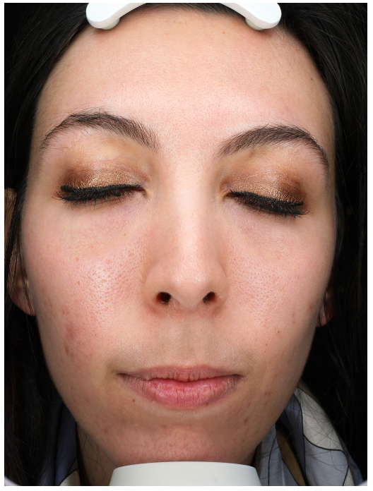 Real Results, Unretouched.