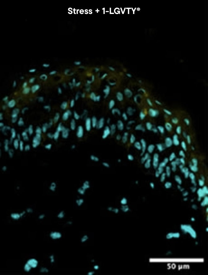 Skin explant under stress treated with 1-LGVTY, IL-1 alpha marker