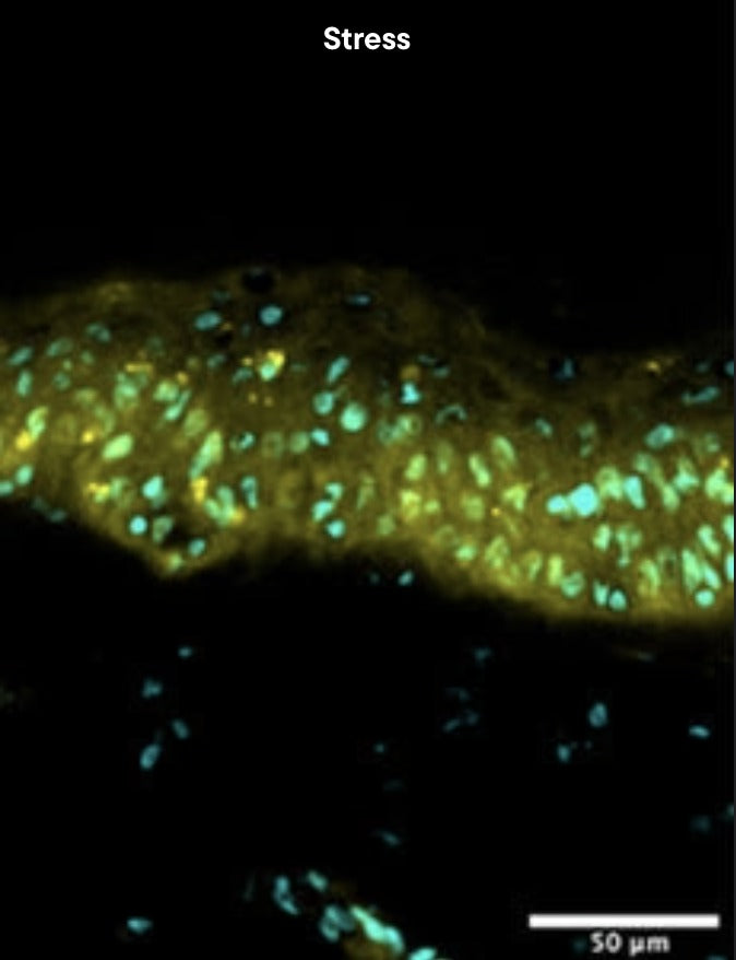 Skin explant under inflammatory stress, IL-1 alpha marker