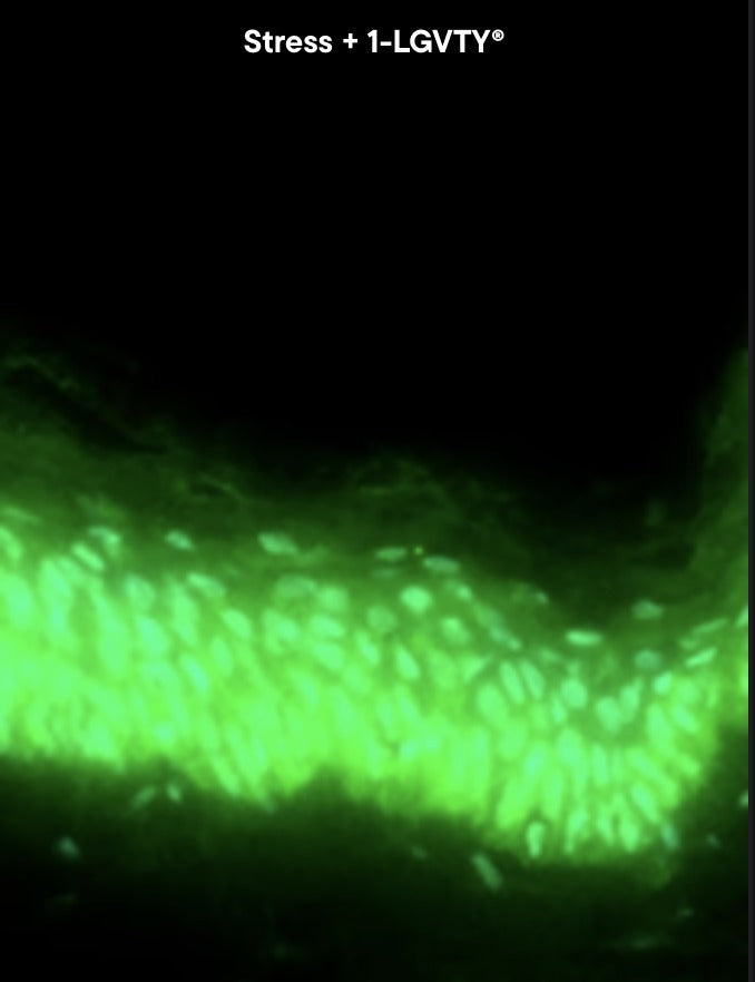 Skin explant under microbiological stress treated with 1-LGVTY, beta-defensin-2