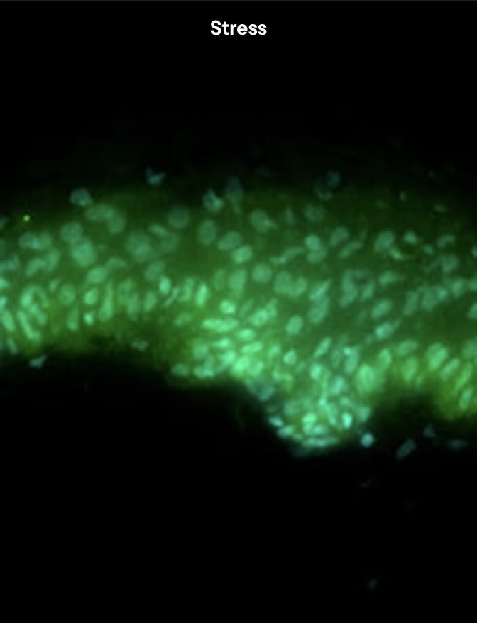 Skin explant under microbiological stress, beta-defensin-2