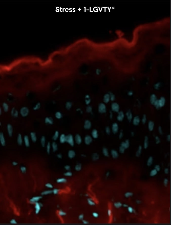 Skin explant under oxidative stress treated with 1-LGVTY, reactive oxygen species