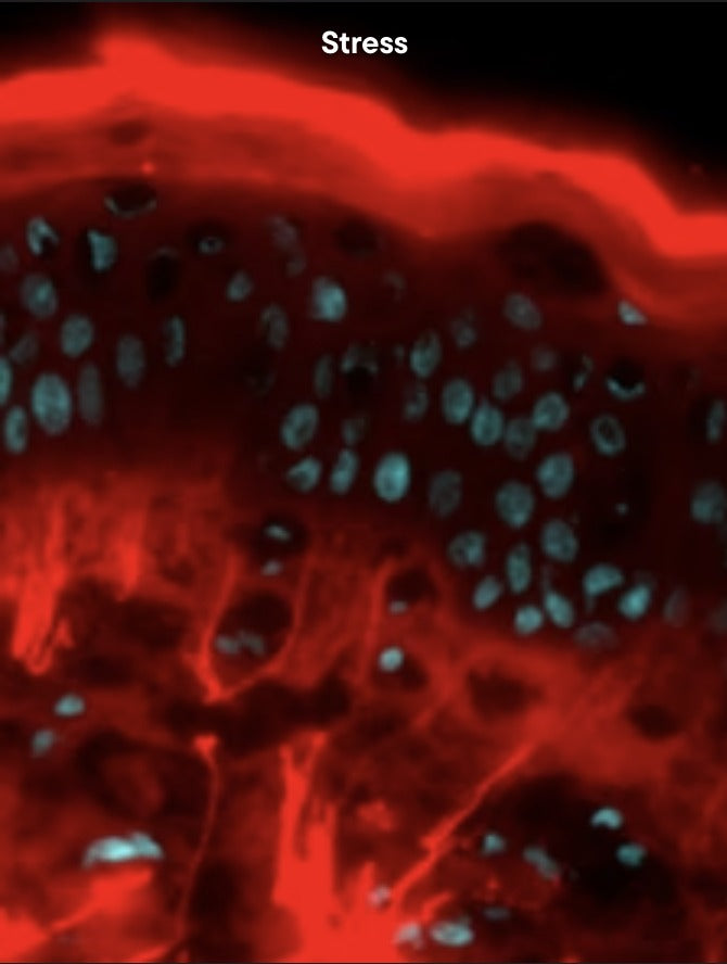 Skin explant under oxidative stress, reactive oxygen species