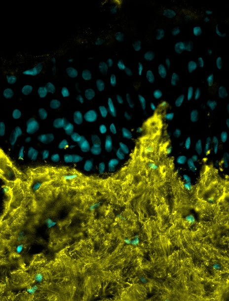 Increased collagen synthesis
