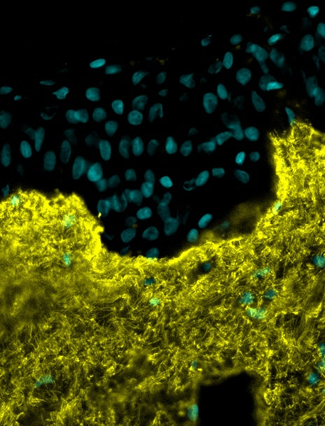 Increased collagen synthesis